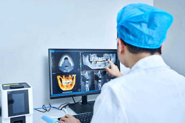 Best Emergency Tooth Extraction in Elton, LA